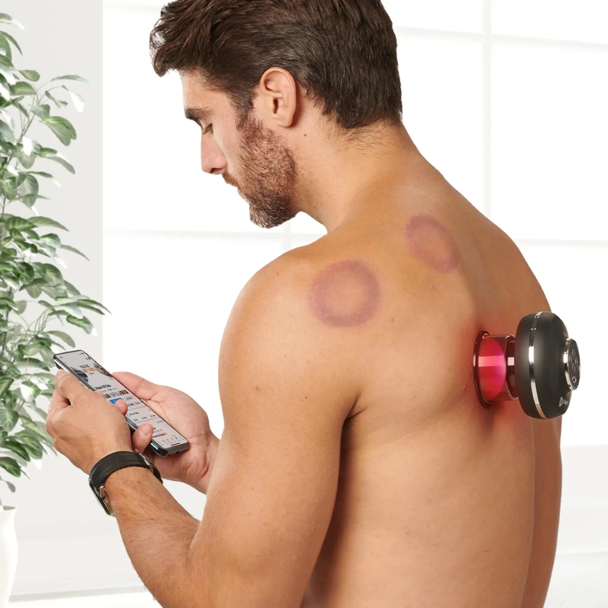 Relievacup™ Smart Cupping Device
